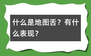 什么是地圖舌？有什么表現(xiàn)？