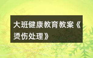 大班健康教育教案《燙傷處理》