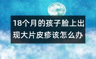 18個(gè)月的孩子臉上出現(xiàn)大片皮疹該怎么辦――宋善路回答