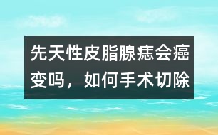 先天性皮脂腺痣會(huì)癌變嗎，如何手術(shù)切除