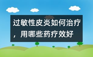 過敏性皮炎如何治療，用哪些藥療效好