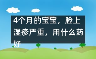 4個(gè)月的寶寶，臉上濕疹嚴(yán)重，用什么藥好