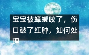 寶寶被蟑螂咬了，傷口破了紅腫，如何處理