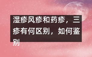 濕疹風(fēng)疹和藥疹，三疹有何區(qū)別，如何鑒別