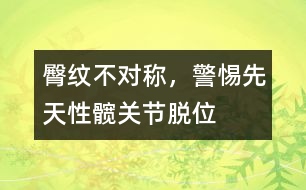 臀紋不對稱，警惕先天性髖關(guān)節(jié)脫位